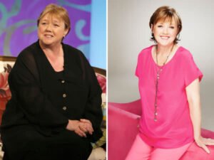 Pauline Quirke Net Worth: Actress’s Journey Amid Dementia Diagnosis